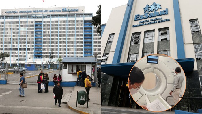 Contraloría detecta fallas en tomógrafos de hospitales Rebagliati y Almenara, que representan riesgo radiológico y pérdida de más de 12 millones de soles