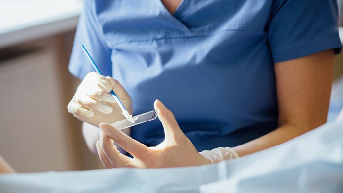 Descubren cómo el cáncer de ovario acelera su metástasis al abdomen mediante la cooperación celular