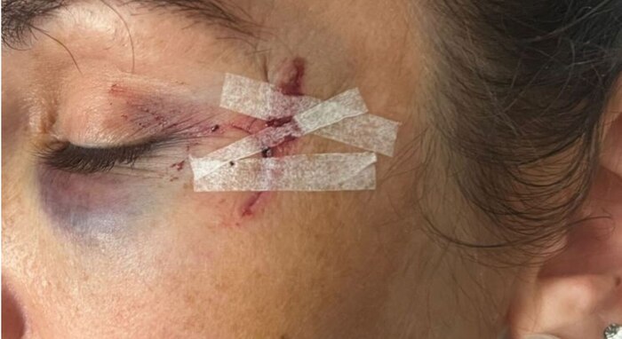 Dictan prisión preventiva a dos mujeres acusadas de tentativa de homicidio en Santa Fe