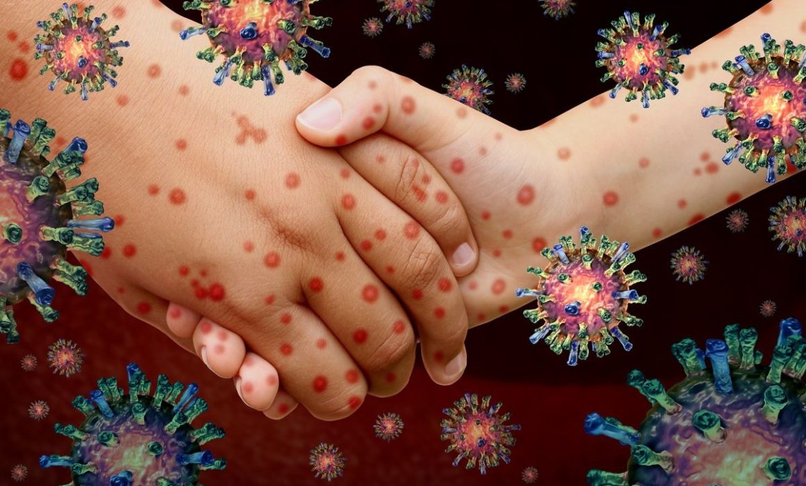 Habilitan centros de vacunación contra el sarampión en Huehuetoca, Estado de México