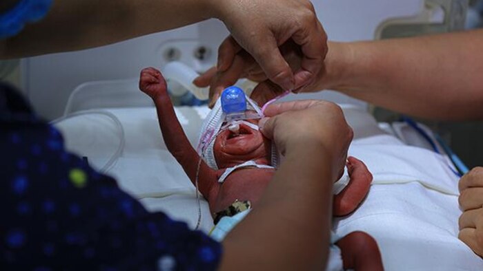 IMSS fortalece atención neonatal con equipamiento avanzado y protocolos especializados para bebés prematuros