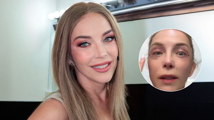 Laura Flores revela detalles de su recuperación tras someterse a una blefaroplastia en los párpados