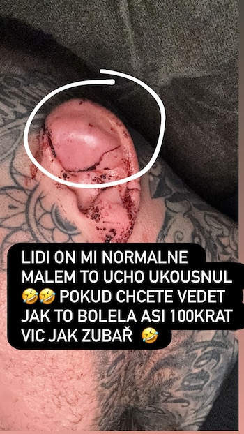 Luchador de MMA en Europa del Este muerde la oreja a su rival y provoca descalificación durante pelea en Clash 15