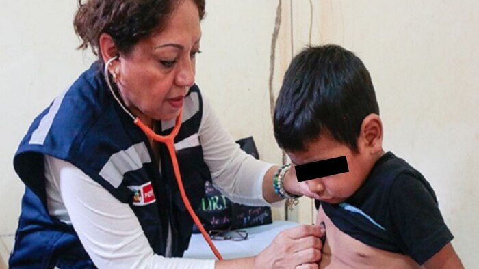 Ministério da Saúde do Peru ativa alerta epidemiológica por risco elevado de sarampo y poliomielite
