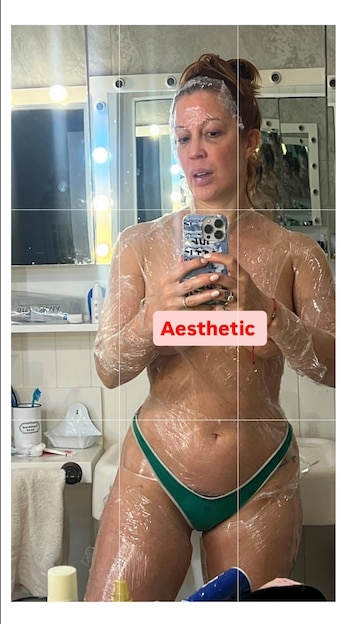 Miriam Lanzoni revela la lucha emocional tras ser diagnosticada con psoriasis en una entrevista