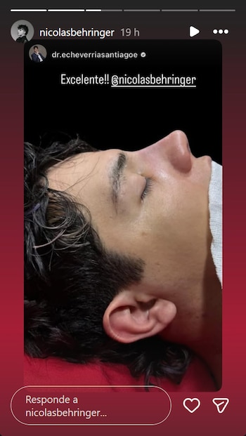 Nicolás Behringer, ganador de La Voz Argentina, se somete a cirugía para mejorar su salud y continuar su carrera musical