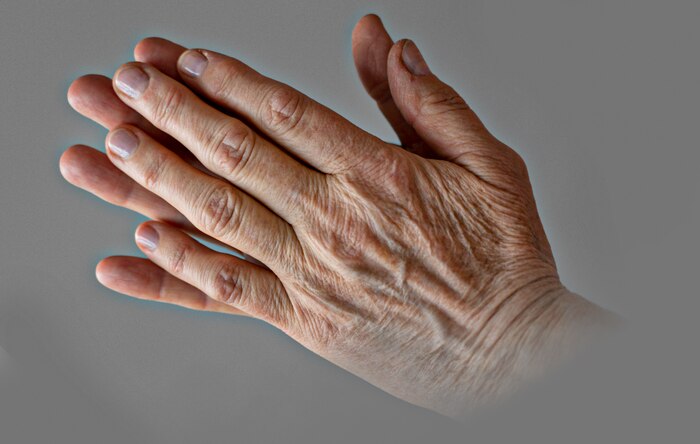 Rejuvenecimiento de manos: tratamientos naturales y procedimientos médicos con ácido hialurónico